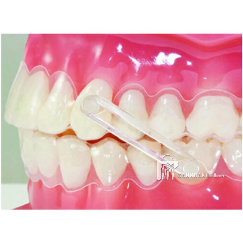 thun liên hàm  - elastics 3/16 -  3.5oz - ảnh sản phẩm thực tế