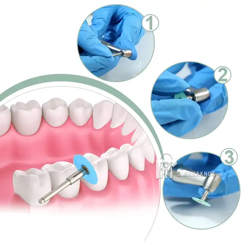 chỉ nha khoa - ảnh sản phẩm thực tế chỉ nha khoa - ảnh sản phẩm thực tế