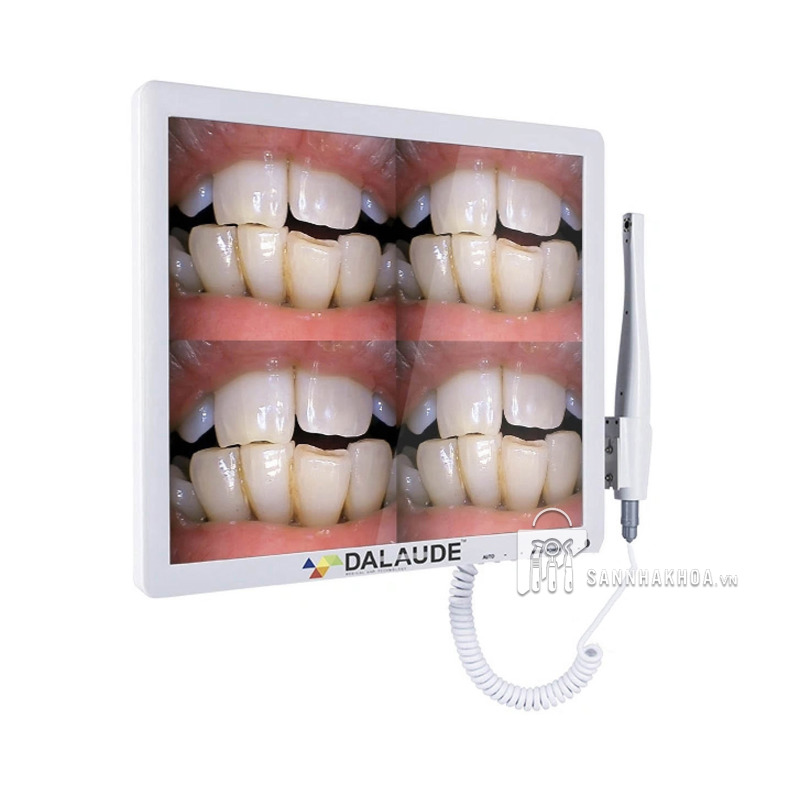 Bộ camera soi răng 17"  màn hình mỏng AVIATION PLUG DA300 Dalaude - ảnh sản phẩm thực tế