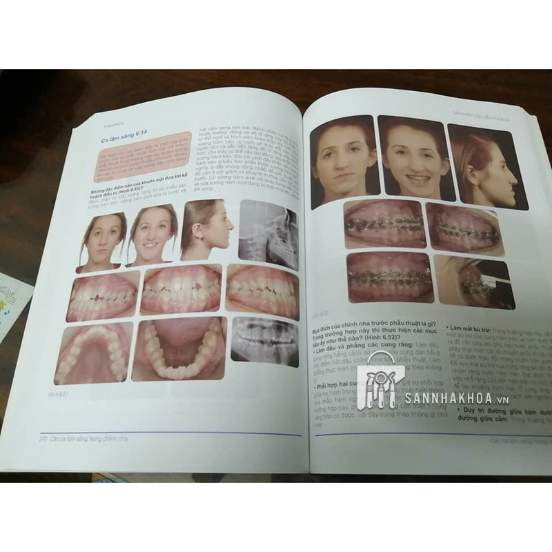 1001 bí kíp lâm sàng trong chỉnh nha - ảnh sản phẩm thực tế