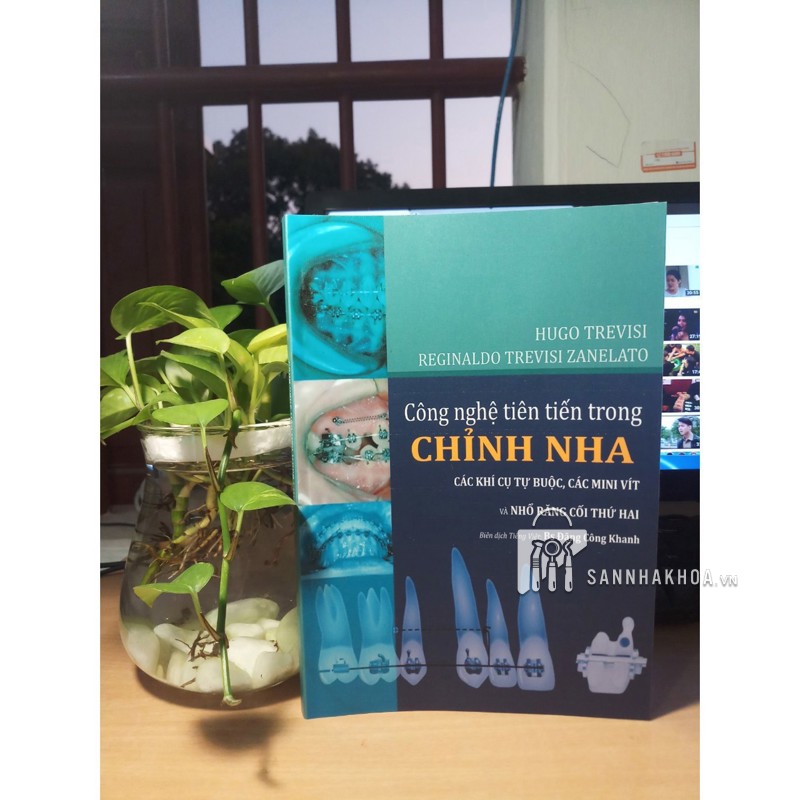 minivis chỉnh nha - ảnh sản phẩm thực tế