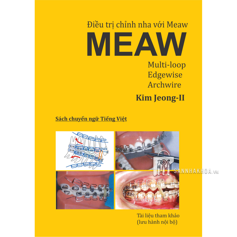 Meaw - Điều trị chỉnh nha với Meaw