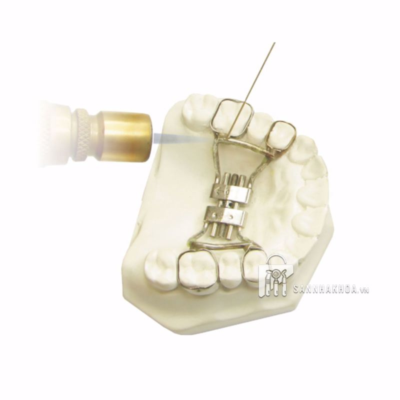 que hàn chỉnh nha leone - ảnh sản phẩm thực tế