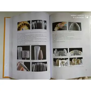 Veneer - Nguyên tắc kế hoạch và kỹ thuật - ảnh sản phẩm thực tế