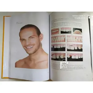 Veneer - Nguyên tắc kế hoạch và kỹ thuật - ảnh sản phẩm thực tế