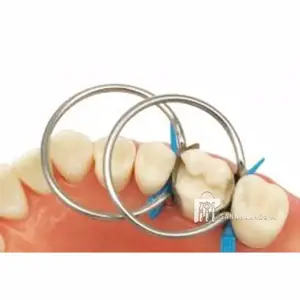 vòng giữ khuôn - ảnh sản phẩm thực tế vòng giữ khuôn - ảnh sản phẩm thực tế