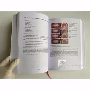 thun chỉnh nha - ảnh sản phẩm thực tế