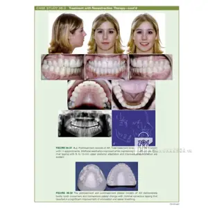 Orthodontics: Current Principles and Techniques - ảnh sản phẩm thực tế