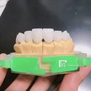 khay nướng sứ - ảnh sản phẩm thực tế khay nướng sứ - ảnh sản phẩm thực tế