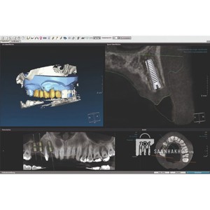 Máy chụp CT KaVo OP 3D Vision Kavo dental technology - ảnh sản phẩm thực tế