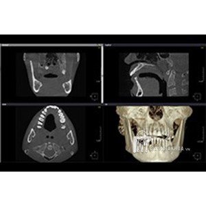 Máy chụp CT KaVo OP 3D Vision Kavo dental technology - ảnh sản phẩm thực tế