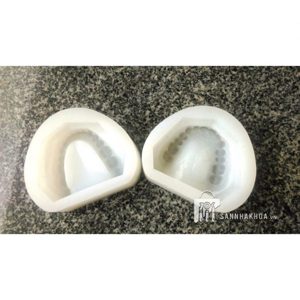 khay đựng mẫu hàm - ảnh sản phẩm thực tế
