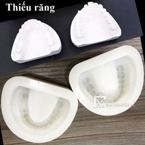 hộp đựng mẫu hàm - ảnh sản phẩm thực tế