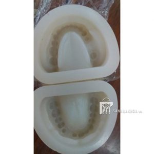 mẫu hàm tháo lắp - ảnh sản phẩm thực tế