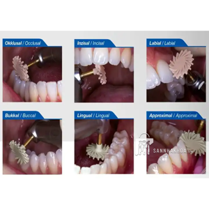 sò đánh bóng - ảnh sản phẩm thực tế sò đánh bóng - ảnh sản phẩm thực tế