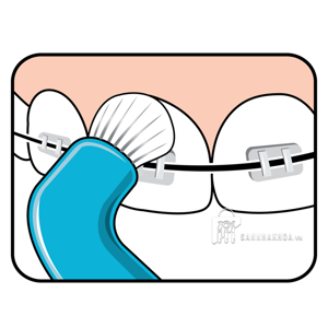 bàn chải răng - ảnh sản phẩm thực tế