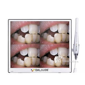 Bộ camera soi răng 17"  màn hình mỏng AVIATION PLUG DA300 Dalaude - ảnh sản phẩm thực tế