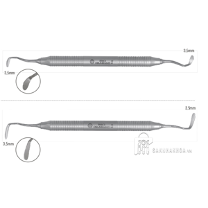 nâng xoang hở - ảnh sản phẩm thực tế