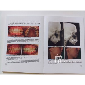 sách chỉnh nha lâm sàn - ảnh sản phẩm thực tế