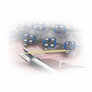 morelli - ảnh sản phẩm thực tế