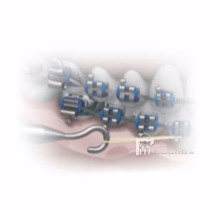 thun morelli - ảnh sản phẩm thực tế