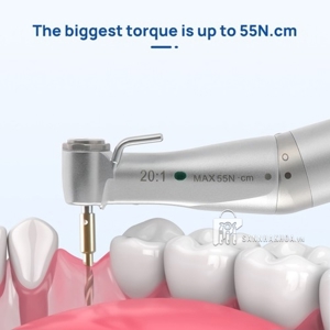 tay khoan implant - ảnh sản phẩm thực tế