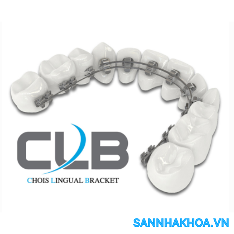Mua Mắc Cài Mặt Lưỡi Choi - Chois Lingual (Bộ 28 Cái) Hubit ️ VAT đầy đủ